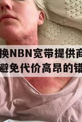 切换NBN宽带提供商，避免代价高昂的错误