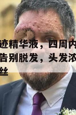 奇迹精华液，四周内助你告别脱发，头发浓密如丝